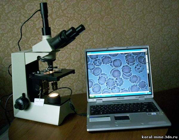 Кровь.Метод гемосканирования. Темнопольный микроскоп.